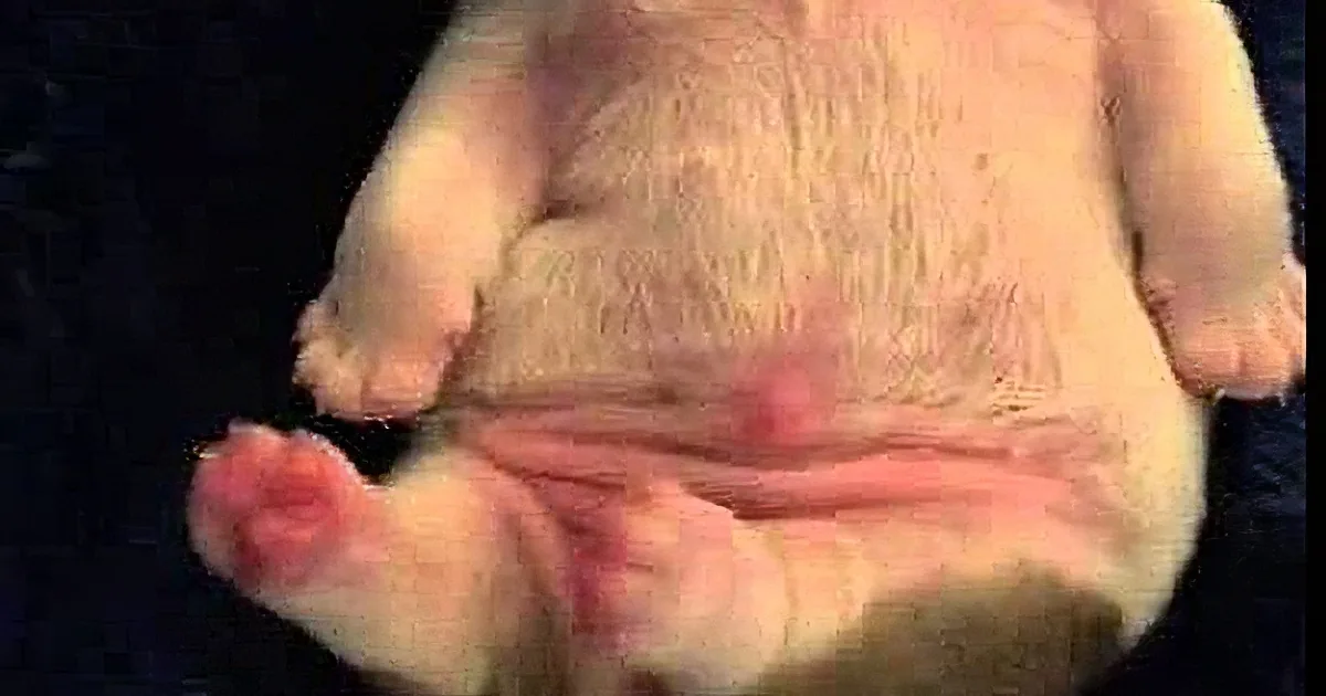 A close-up of a dog's belly showing its underside with visible nipples and a pinkish hue.