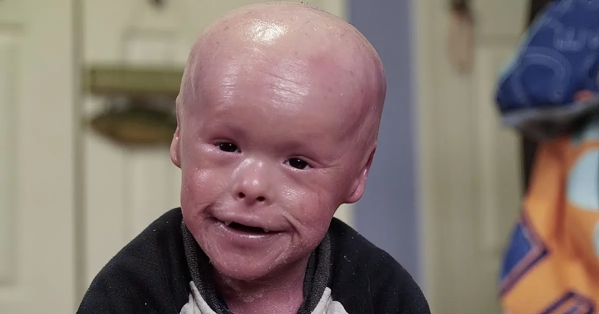 A baby with a bald head and a smiling expression, wearing a dark outfit, is the main subject of the image.