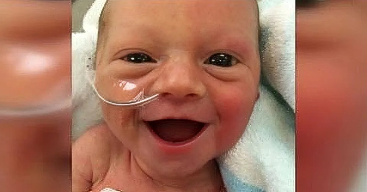 A newborn baby smiles widely, wearing a nasal cannula, wrapped in a white blanket.