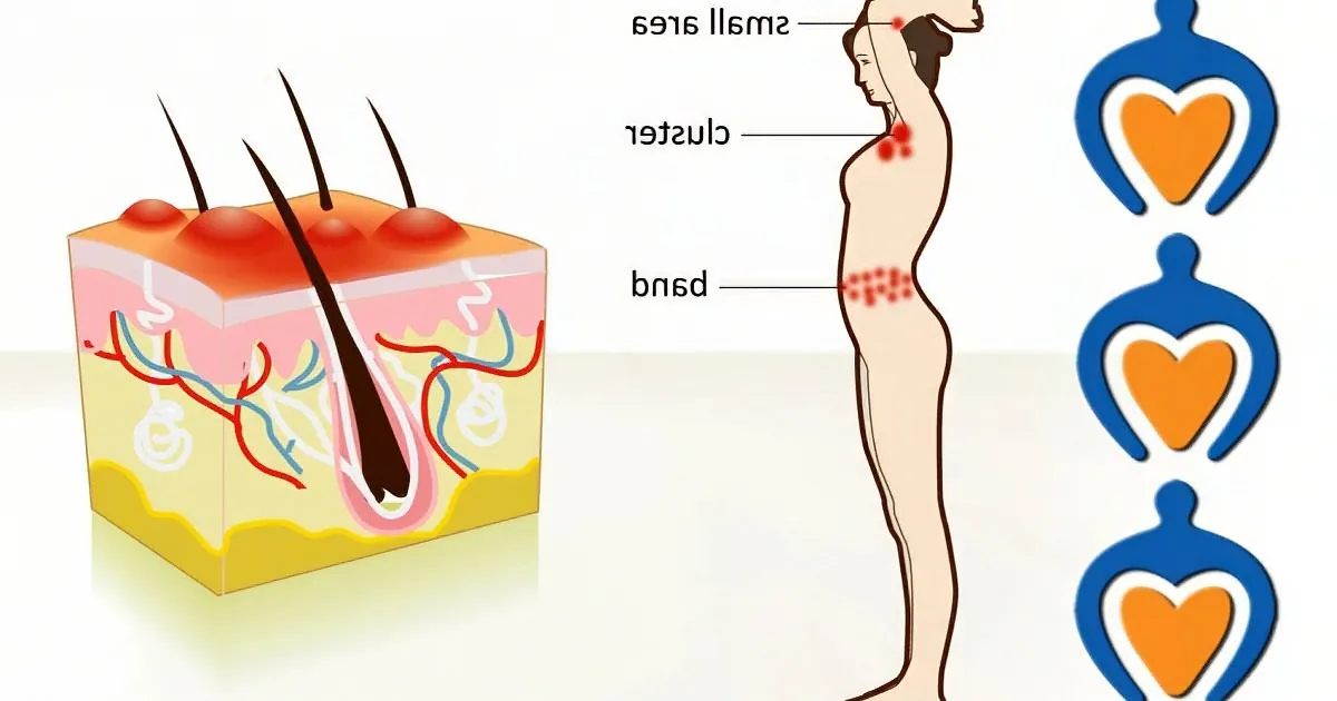 This Is What Shingles Actually Is and Here Are the Easiest Ways to Naturally Treat It at Home