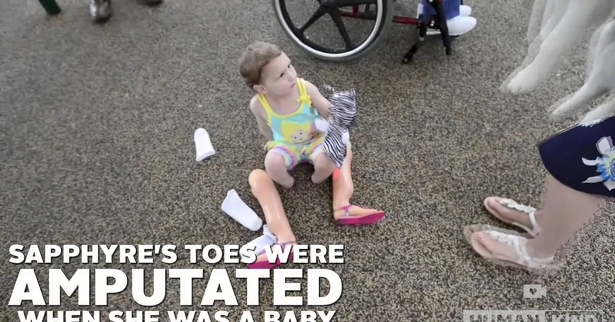 A toddler sits on the ground surrounded by prosthetic limbs, wearing a colorful outfit and pink shoes.