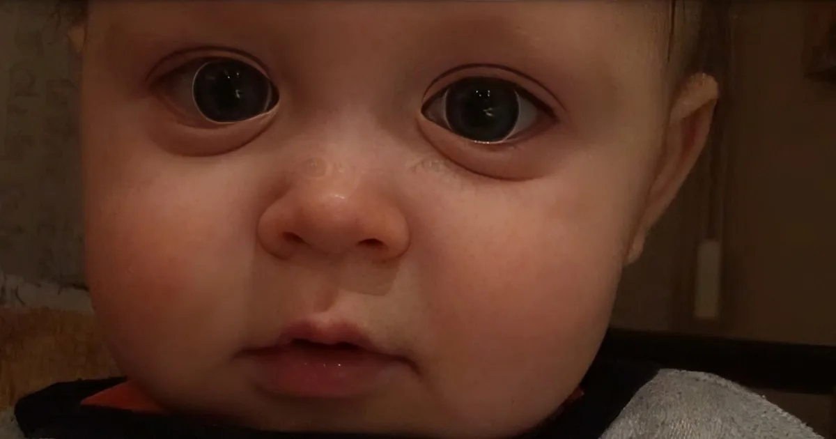 A close-up of a baby's face with large, expressive eyes and a slightly open mouth.